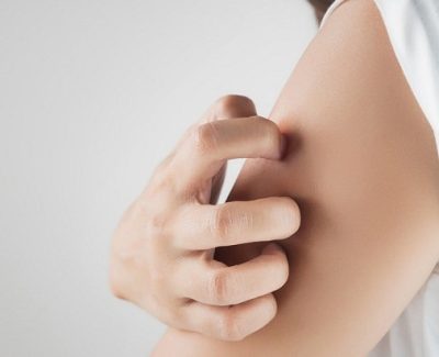Démangeaisons de la peau : quelles peuvent être les causes ?