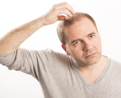 Traitement contre la calvitie : les effets secondaires sur la libido